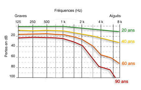Audiogramme Neuroreille